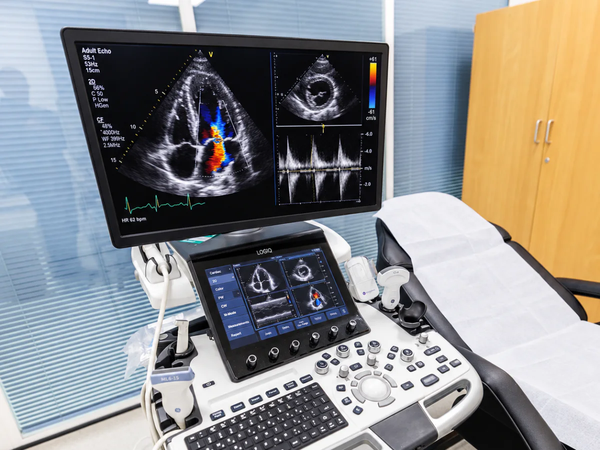 Echo Heart Scan