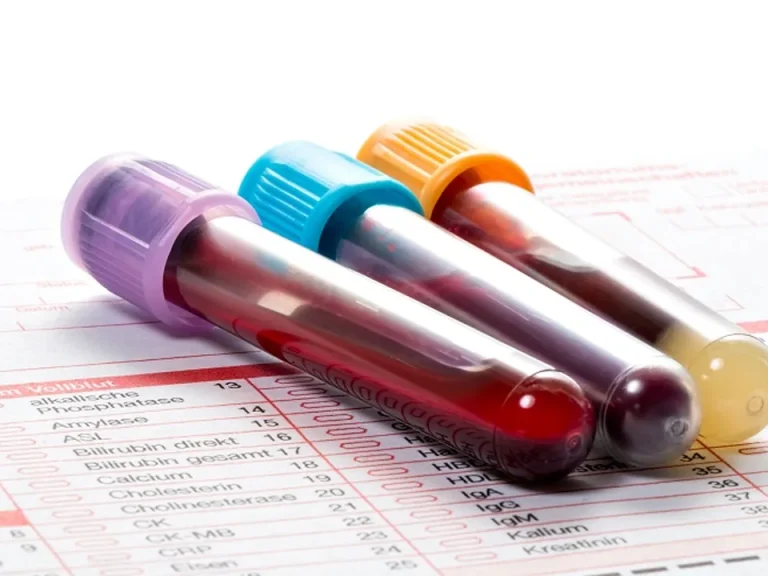 Extended blood testing setup for a comprehensive health assessment